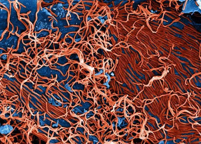 Bild: Ebola: Frühe Immunantwort gibt Aufschluss über Impfschutz