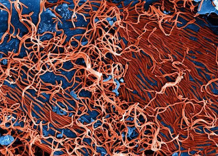 Bild: Ebola: Frühe Immunantwort gibt Aufschluss über Impfschutz