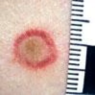 Neues Webportal ava2.de unterstützt Ärzte bei der Diagnose „Häusliche Gewalt“ Bild: Neues Webportal ava2.de unterstützt Ärzte bei der Diagnose „Häusliche Gewalt“