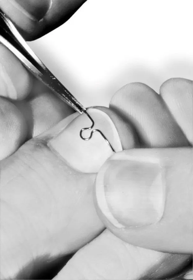 Qualifizierte Fuß- und Nagelbehandlung durch Podologen