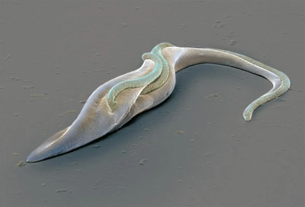Rasterelektronenmikroskopische Aufnahme eines Trypanosoms. ( Dr. Christopher Jackson - IKELOS. )