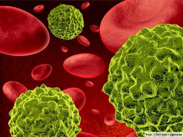 Skandalöse Zustände im Kampf gegen Krebs Bild: Skandalöse Zustände im Kampf gegen Krebs