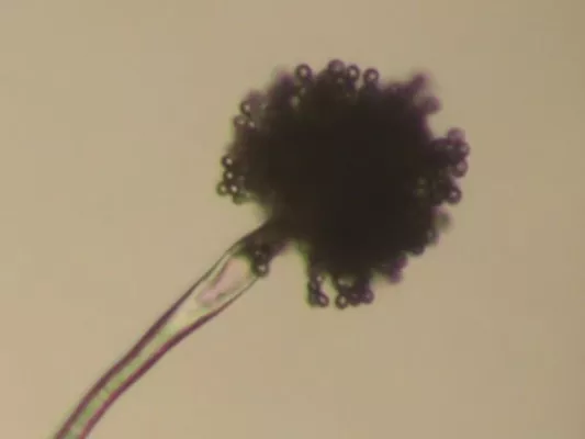 Bild: Lebensmittelbiotechnologie zur mehr Lebensmittelsicherheit