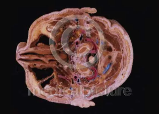 Bild: Eine Reise ins Innere des Körpers - faszinierende Bilder bei medicalpicture.de