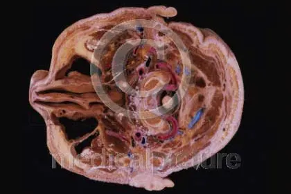 Bild: Eine Reise ins Innere des Körpers - faszinierende Bilder bei medicalpicture.de