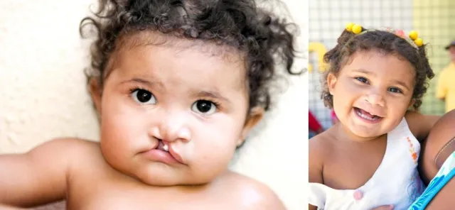 Bild: „Operation Smile“: Kofferhersteller Stratic sponsert Trolleys für internationale Hilfseinsätze