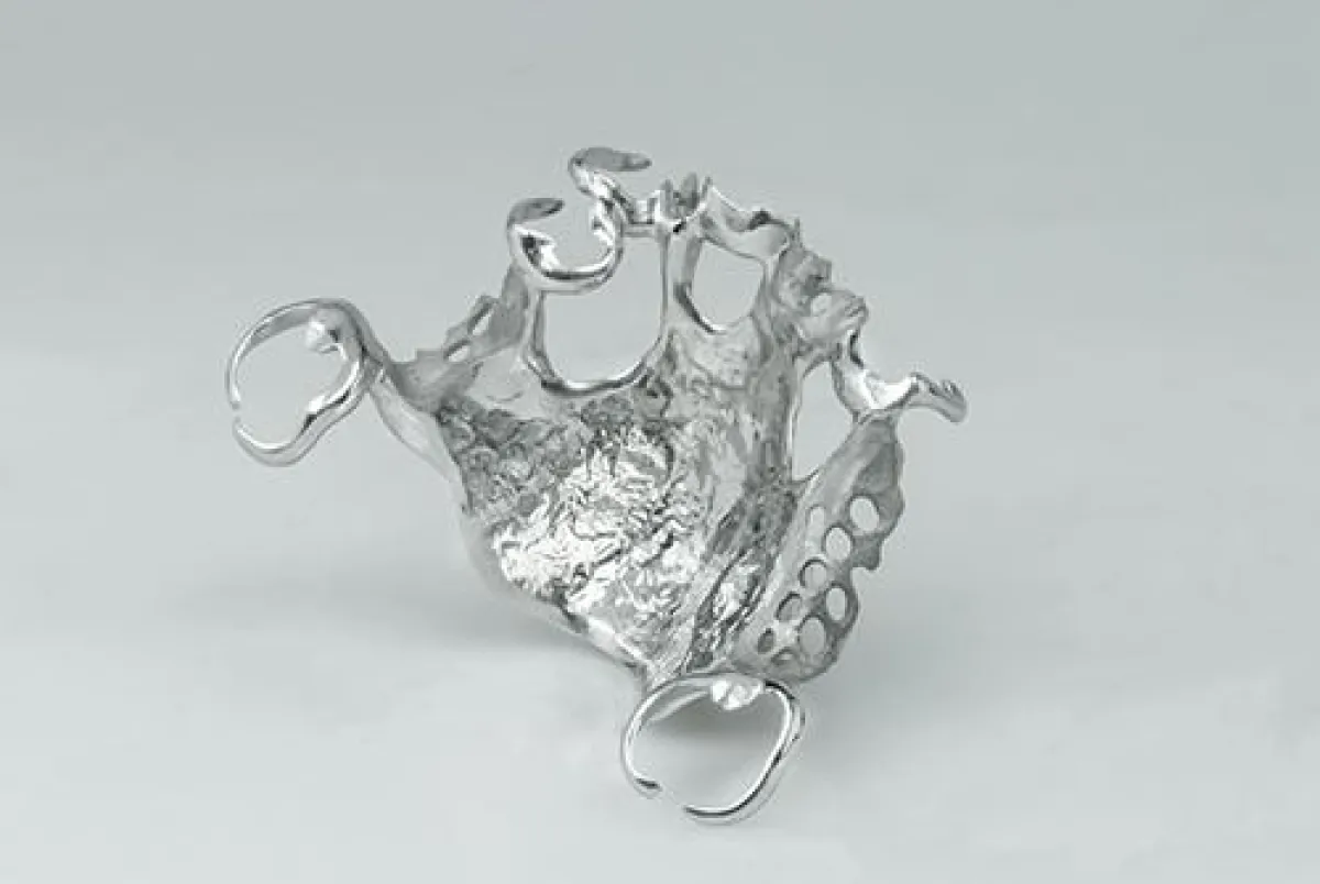 Digitaler Modellguss