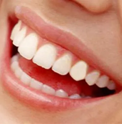 Bild: Zahnarzt Preisvergleich - nicht der billigste Preis zählt