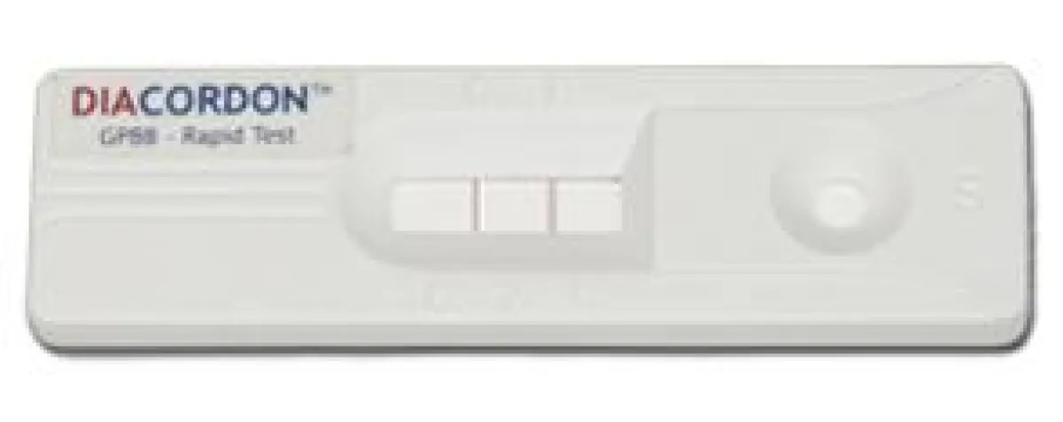 Herzinfarkt - Ja oder Nein? Der Diacordon POCT ermöglicht eine schnelle Diagnose