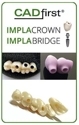 Bild: CADfirst IMPLACROWN und IMPLABRIDGE für CAD/CAM Implantatversorgungen