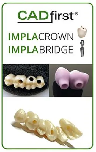 Bild: CADfirst IMPLACROWN und IMPLABRIDGE für CAD/CAM Implantatversorgungen