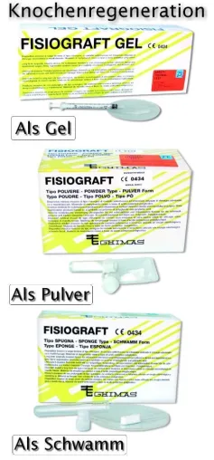 Bild: Knochenregenerationsmaterial in drei Konsistenzen