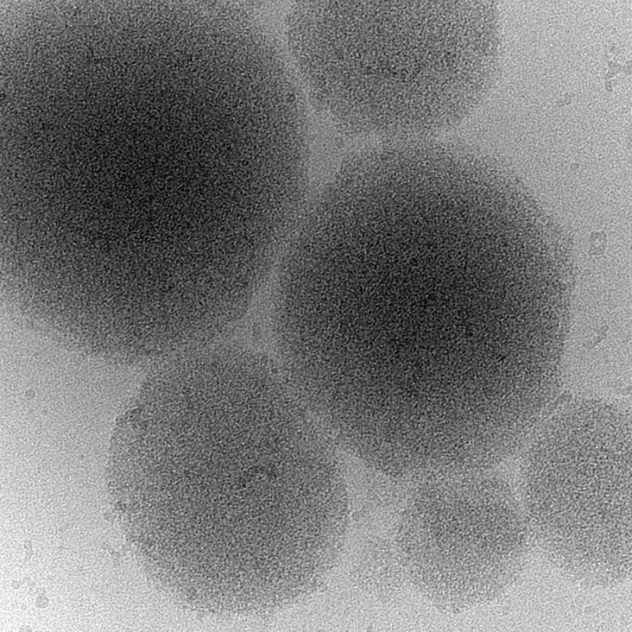 Kryo-Elektronenmikroskopie-Abbildung eines biomolekularen Kondensates eines Prionproteins (MPI für Molekulare Zellbiologie und Genetik)