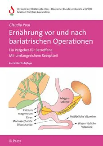 Bild: Ernährung vor und nach bariatrischen Operationen: ausschlaggebend für den langfristigen Erfolg