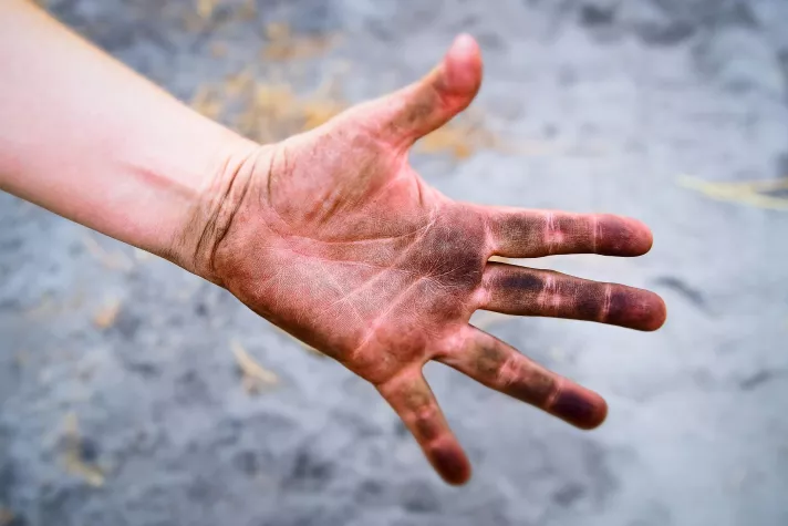 Bild: Hygiene to go für Kinder – aber bitte ohne Alkohol!