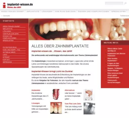 NEU: Patientenratgeber mit aktuellen, unabhängigen Informationen zum Thema Zahnimplantate Bild: NEU: Patientenratgeber mit aktuellen, unabhängigen Informationen zum Thema Zahnimplantate