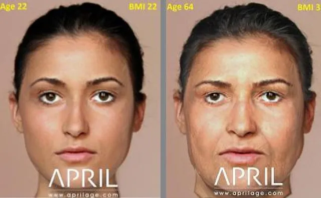 Neue Version von APRIL® Face Aging Software mit Body Mass Index Vorhersage Bild: Neue Version von APRIL® Face Aging Software mit Body Mass Index Vorhersage