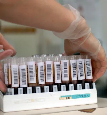 Bild: Spezialetiketten von Mediaform steigern Sicherheit im Labor