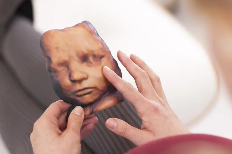 Startup druckt mehrfarbige 3D Masken von ungeborenen Babys Bild: Startup druckt mehrfarbige 3D Masken von ungeborenen Babys