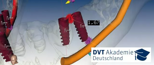 Bild: Stichtag 16. Mai: DVT Fachkunde-Kurs für Zahnmedizin und HNO-Heilkunde & Aktualisierung im Strahlenschutz.