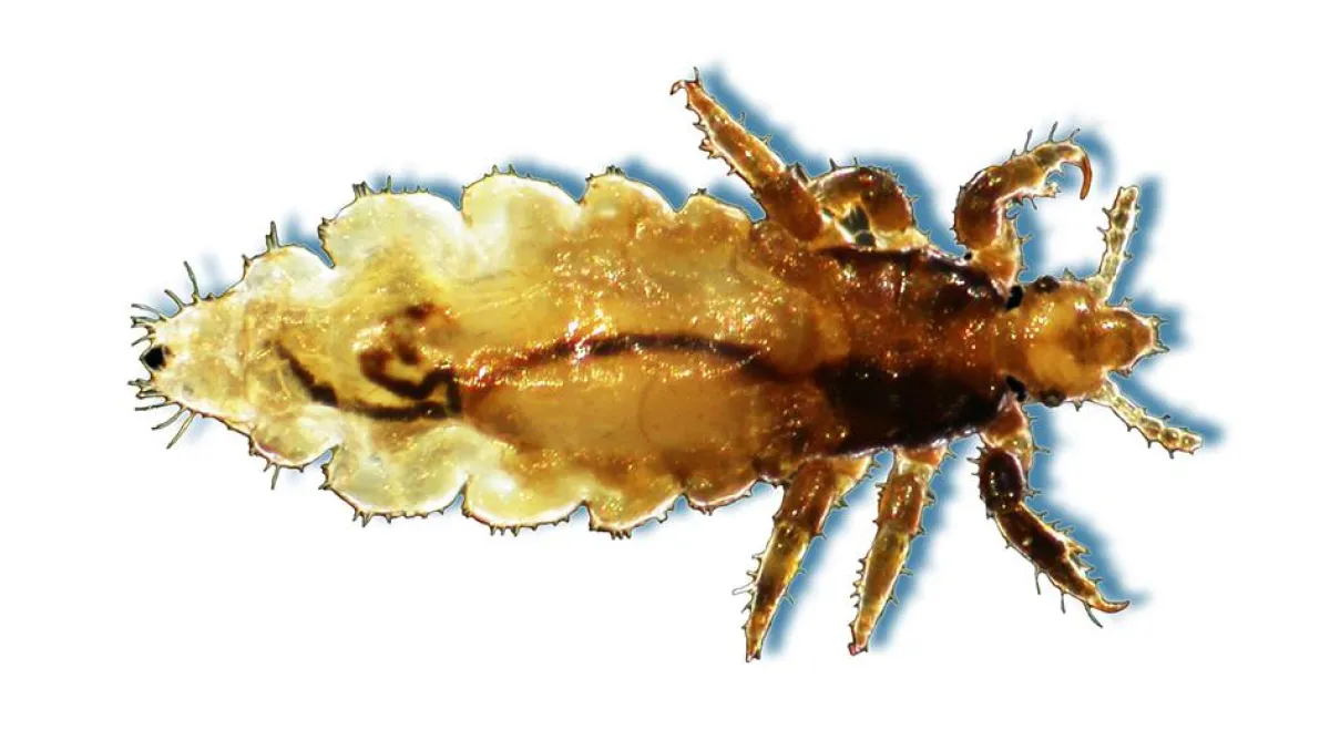 Elektronenmikroskop-Aufnahme einer Kopflaus (Pediculus humanus capitis). Originalgröße: 2 bis 3 mm. Fotocredit: H. Prosl