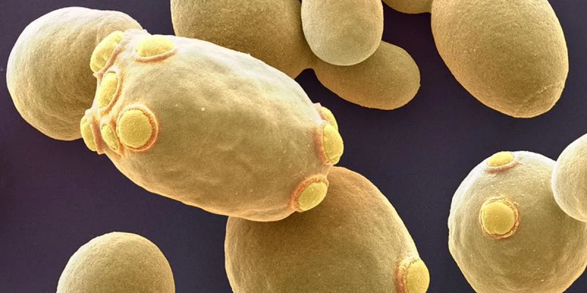 Die Bäckerhefe Saccharomyces cerevisiae.  ((Bild: Universität Basel/SNI/Nano Imaging Lab))