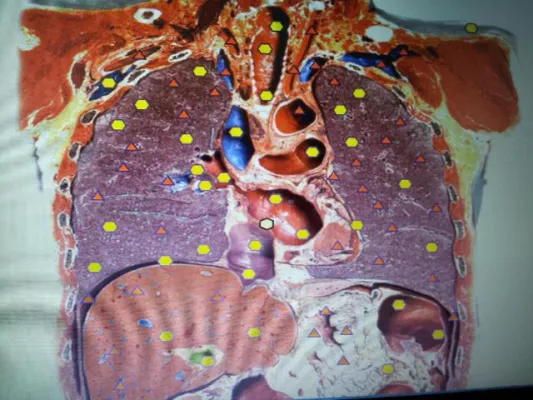 Neue ganzheitliche Methode: Darstellung von Körperbelastungen auch schon bevor Symptome auftreten Bild: Neue ganzheitliche Methode: Darstellung von Körperbelastungen auch schon bevor Symptome auftreten
