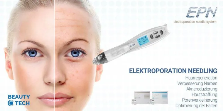 Bild: EPN-Microneedling