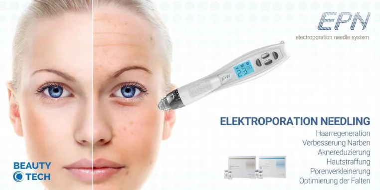 EPN-Microneedling Bild: EPN-Microneedling
