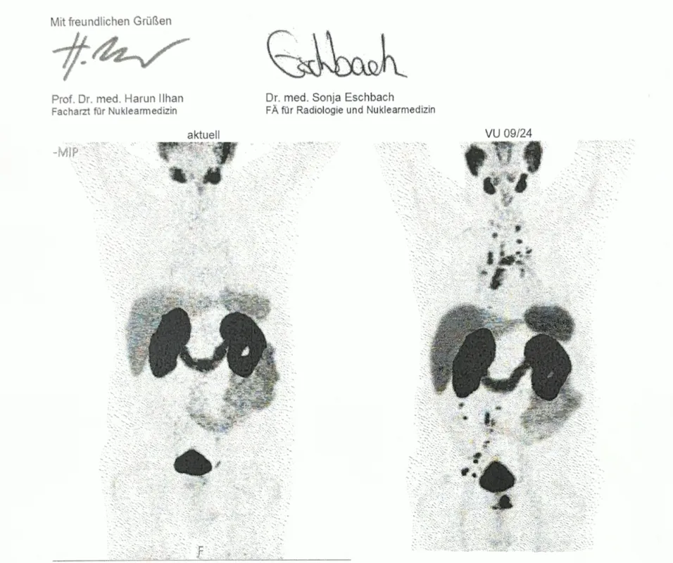 Rechts: erschöpft durch Prostatakarzinom. Links: mehr Klarheit, Energie & Vitalität.
