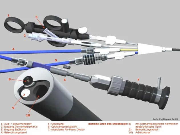 Bild: Zivilisationskrankheit Nierensteinleiden