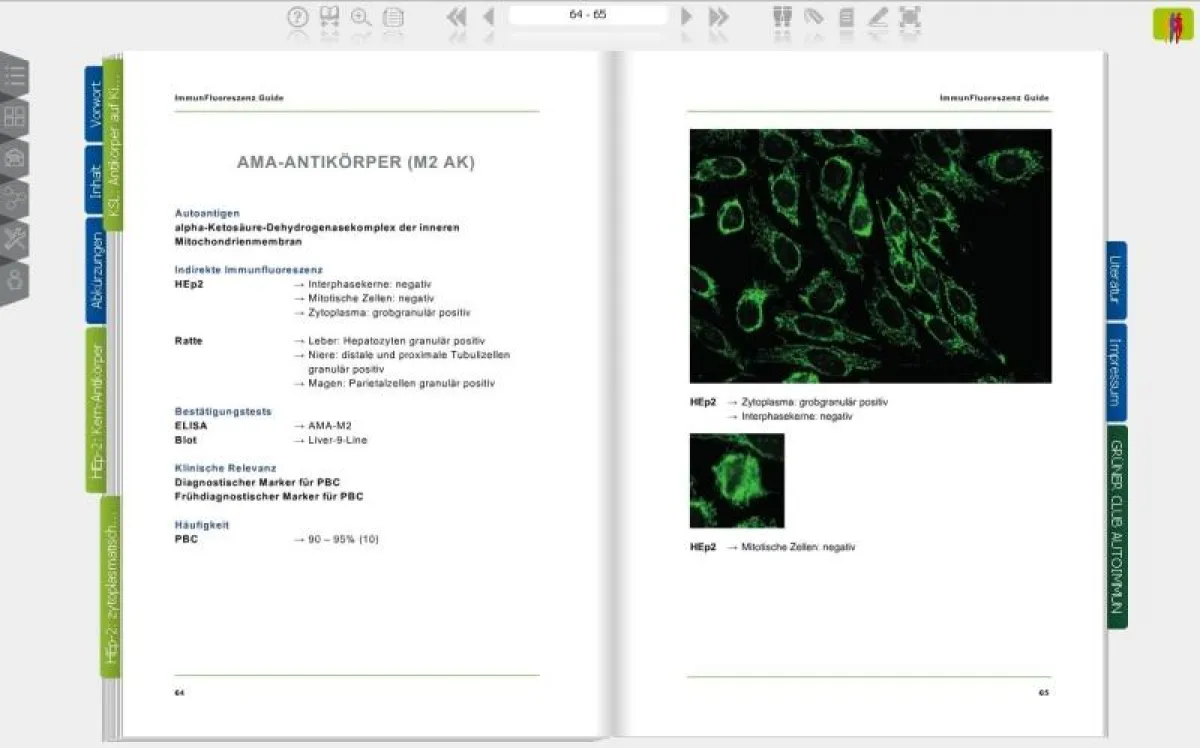Hilft bei der Auswertung von Immunfluoreszenz-Tests: Der Online-Immunfluoreszenz-Guide für das moder
