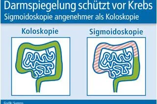 Bild: Darmspiegelung kann vor Krebs schützen