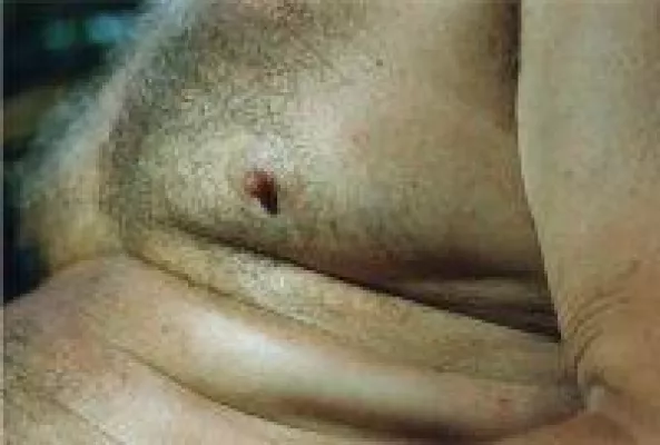 Bild: Der (un)heimliche Dickmacher Fruktose!?