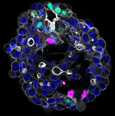 Patientenspezifisches Modell der menschlichen Leber zur Erforschung von Krankheiten Bild: Patientenspezifisches Modell der menschlichen Leber zur Erforschung von Krankheiten