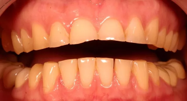 Bild: Zu viel Stress am Steuer - GZFA: Entspanntes Autofahren ist auch für Zähne besser