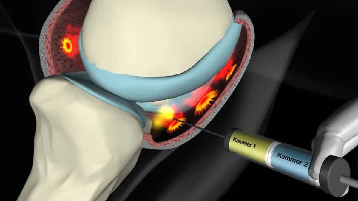 Die Doppelkammerspritze mit Hyaluronsäure hilft Hunden mit Arthrose
