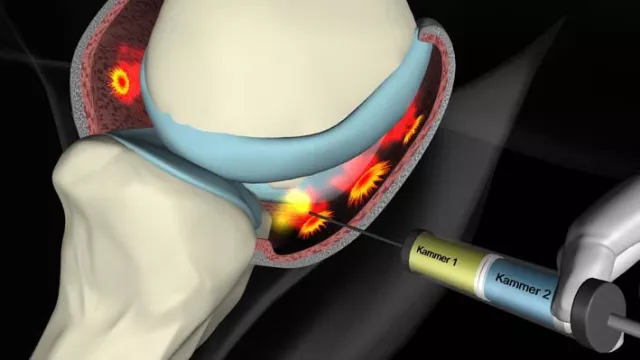 Bild: Arthrosebehandlung beim Hund