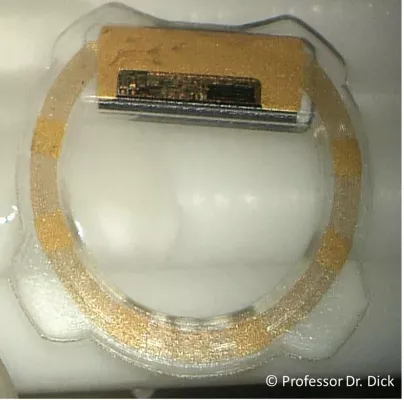 Kleiner Hightech-Sensor im Auge hilft Patienten mit Grünem Star Bild: Kleiner Hightech-Sensor im Auge hilft Patienten mit Grünem Star