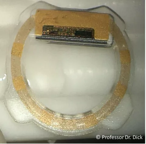 Bild: Kleiner Hightech-Sensor im Auge hilft Patienten mit Grünem Star