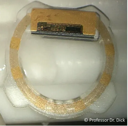 Bild: Kleiner Hightech-Sensor im Auge hilft Patienten mit Grünem Star