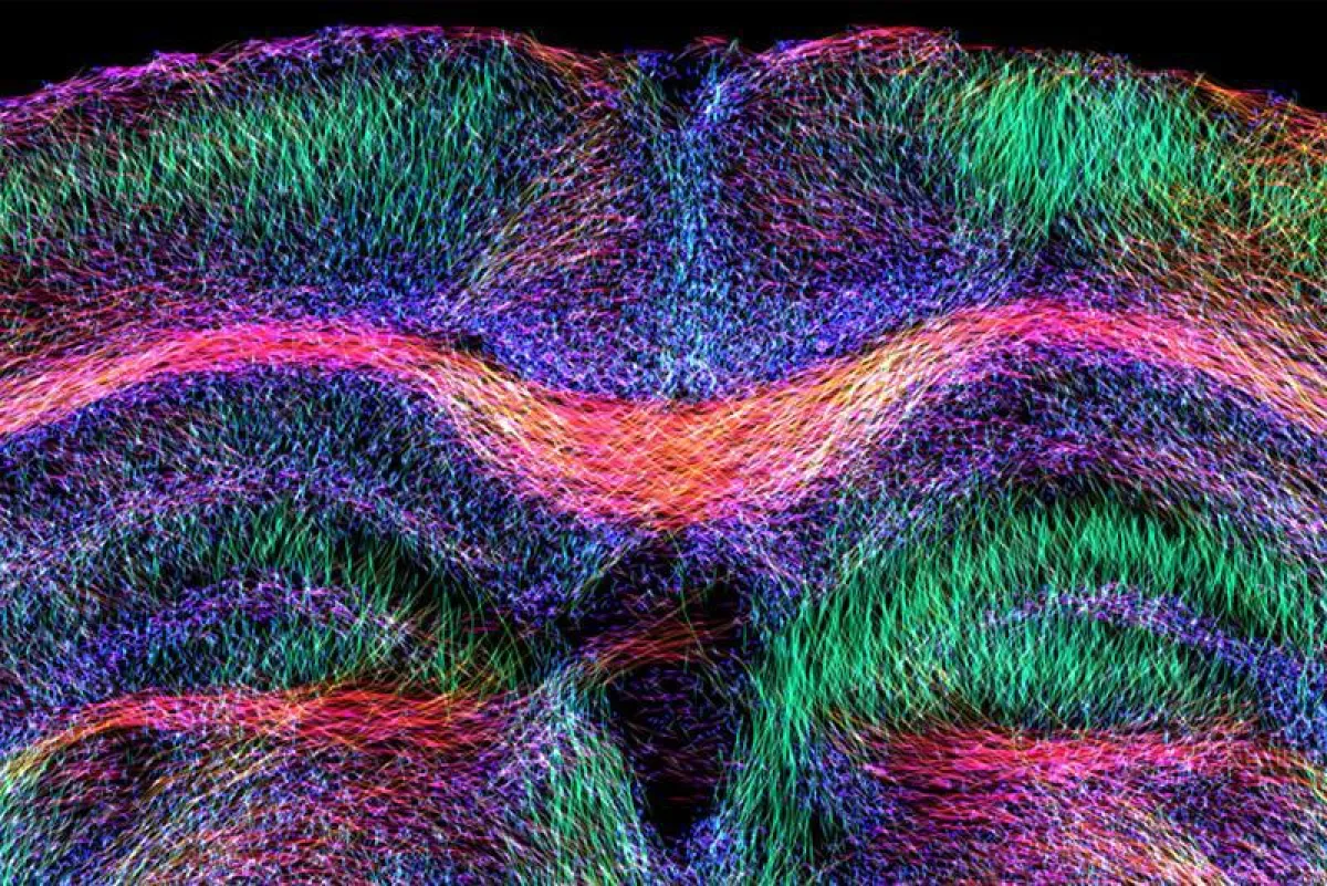 Caption: See press release ()