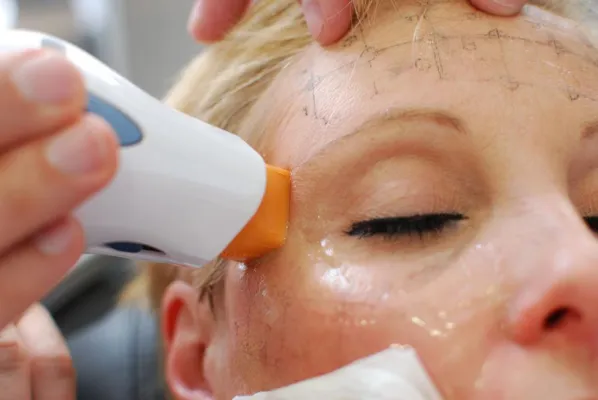 Bild: Sanfte Behandlung von Schlupflidern