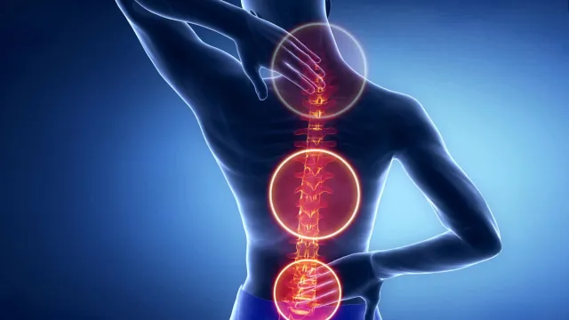 Bild: Warum Rückenschmerzen in Berlin oft falsch behandelt werden – und welche Rolle Liebscher & Bracht spielt