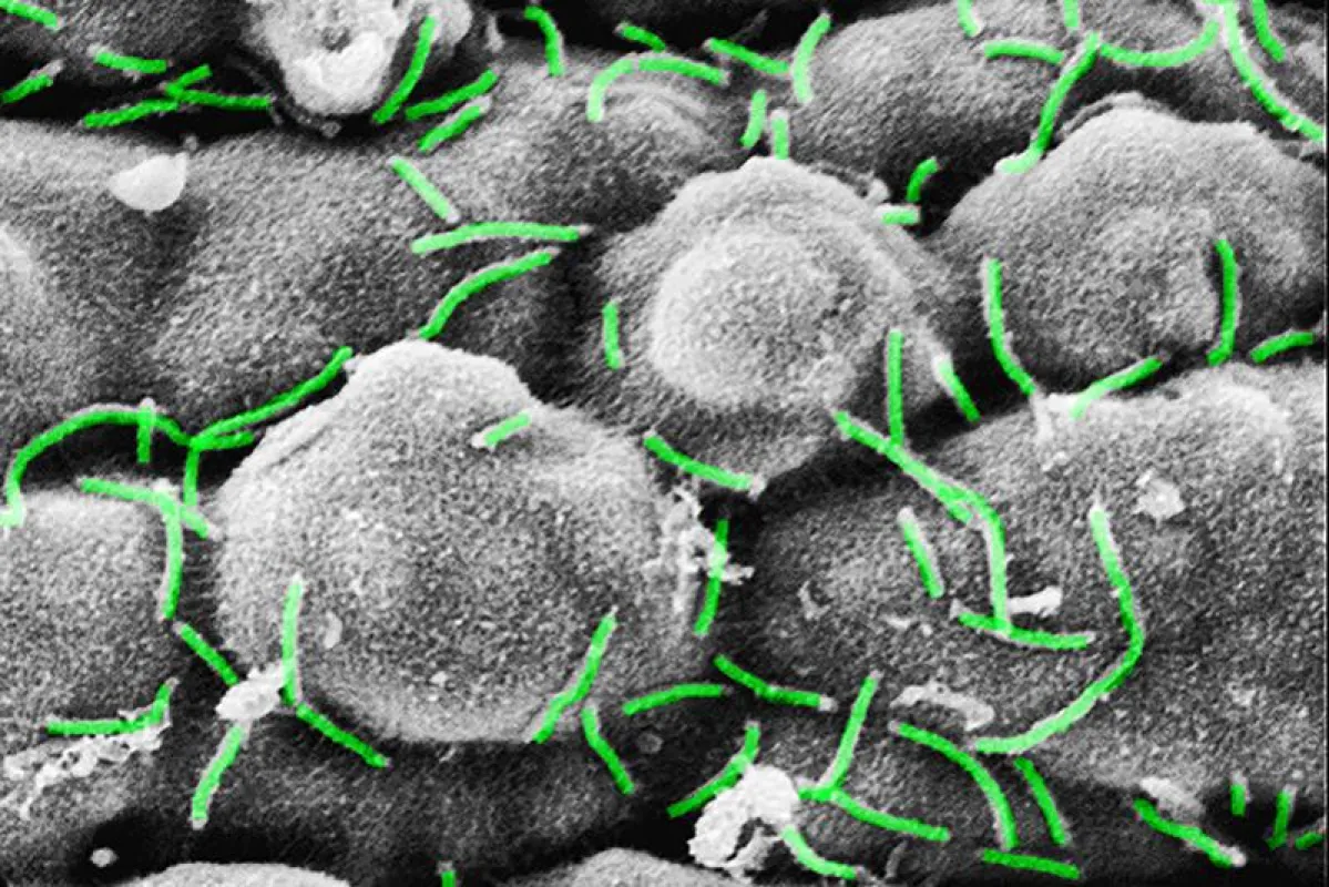 Electron microscopic image of the bacterial communities (Curvibacter sp.) on the surface of Hydra. (Image: Katja Schröder)
