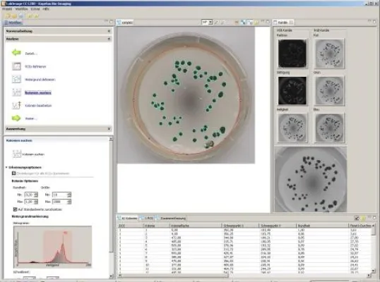 Bild: Neue Software zur automatischen Zählung von Kolonien und Spots in der Biologie, Medizin und Mikrobiologie.