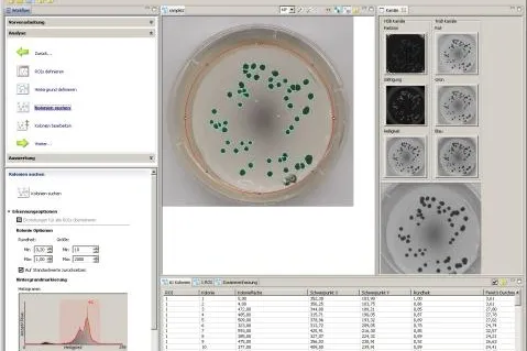 Bild: Neue Software zur automatischen Zählung von Kolonien und Spots in der Biologie, Medizin und Mikrobiologie.