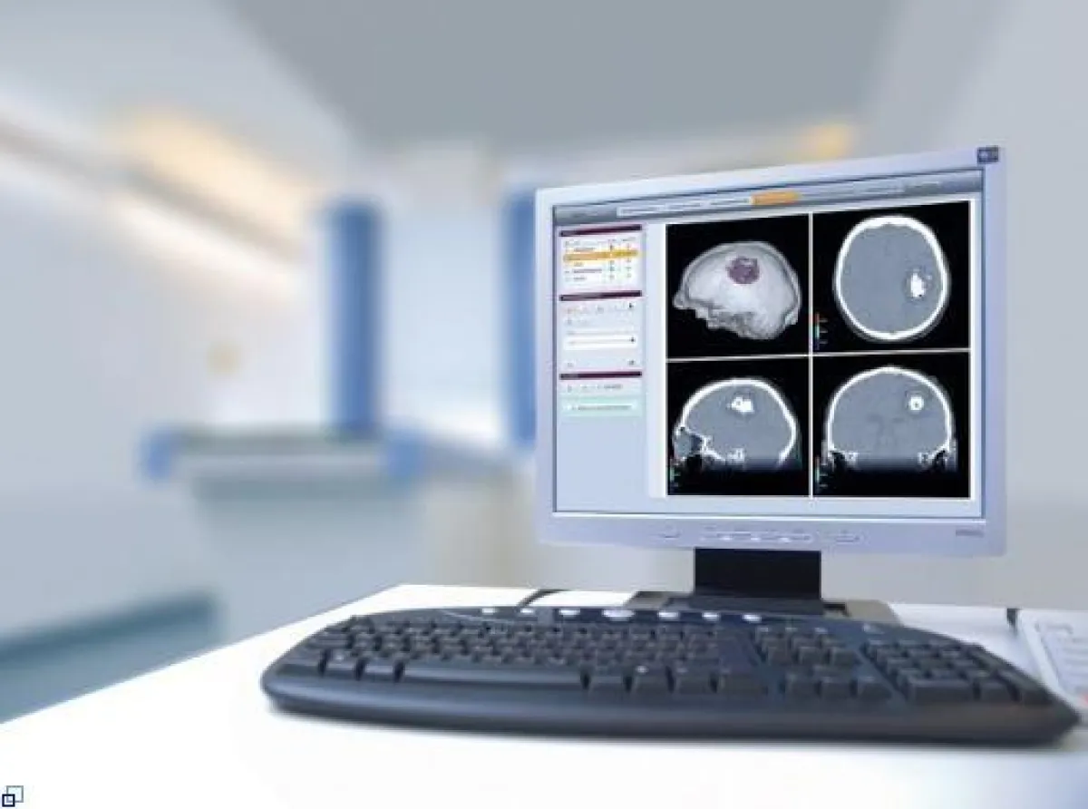 NanoPlan® temperatursimulations-Software (©MagForce)