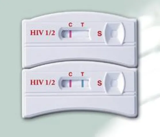 HIV-Tests für alle zugänglich Bild: HIV-Tests für alle zugänglich