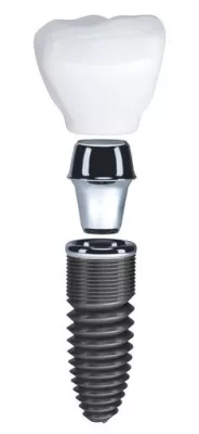 Bild: Implantatpraxis in Berlin: Keramikimplantate noch unausgereift